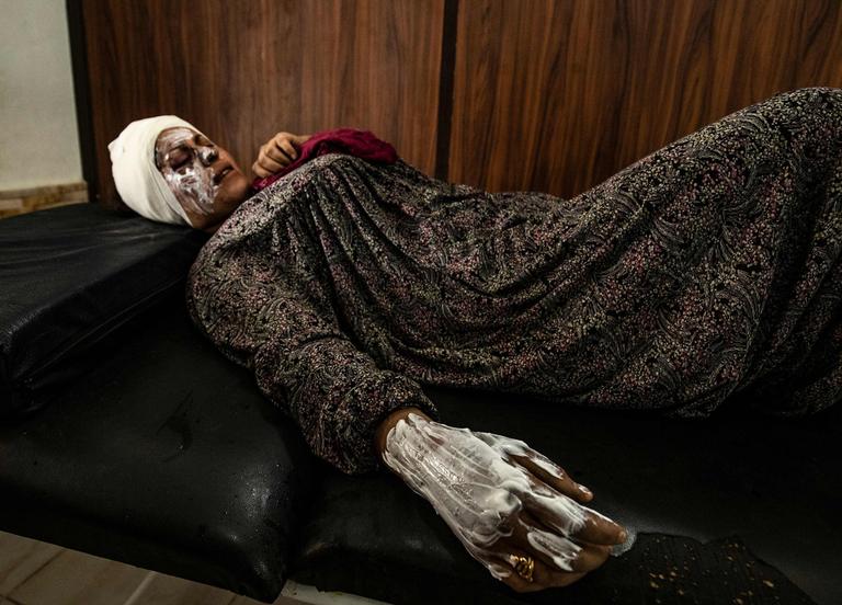 Une femme syrienne, touchée durant le bombardement de Ras al-Aïn, est soignée dans un hôpital de Tal Tamr, le 11 octobre.