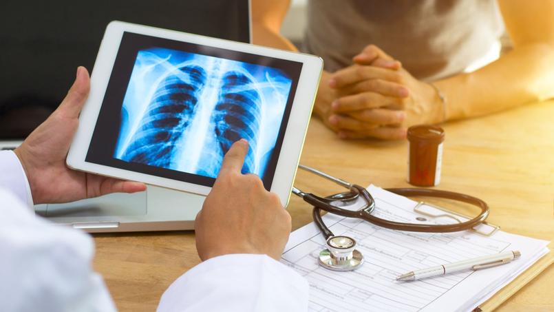 Cancer Poumon Combien De Temps A Vivre Cancer du poumon: une application améliore la survie des malades