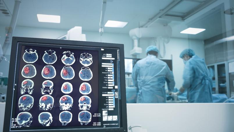 AVC : chaque minute compte pour votre cerveau