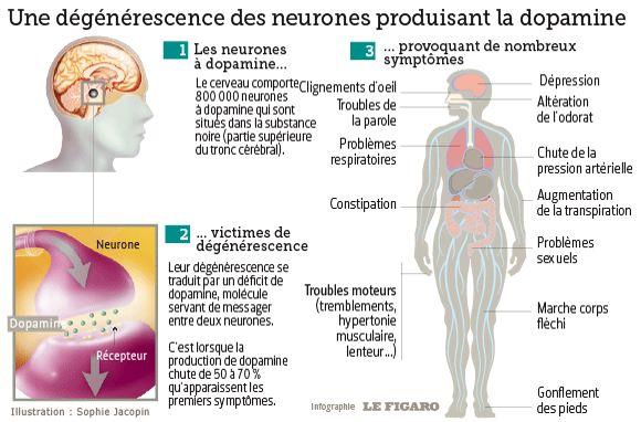 10 Choses à Savoir Pour Mieux Comprendre La Maladie De Parkinson