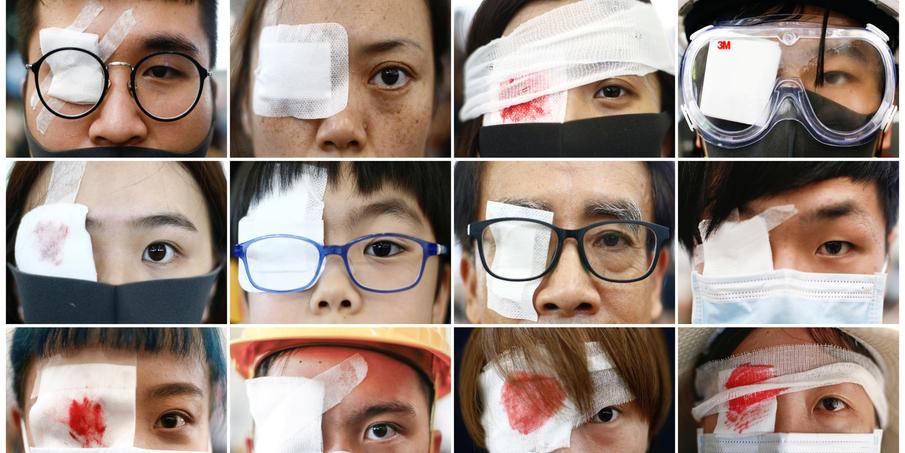 Œil pour œil»: les manifestants de Hongkong dénoncent les violences  policières