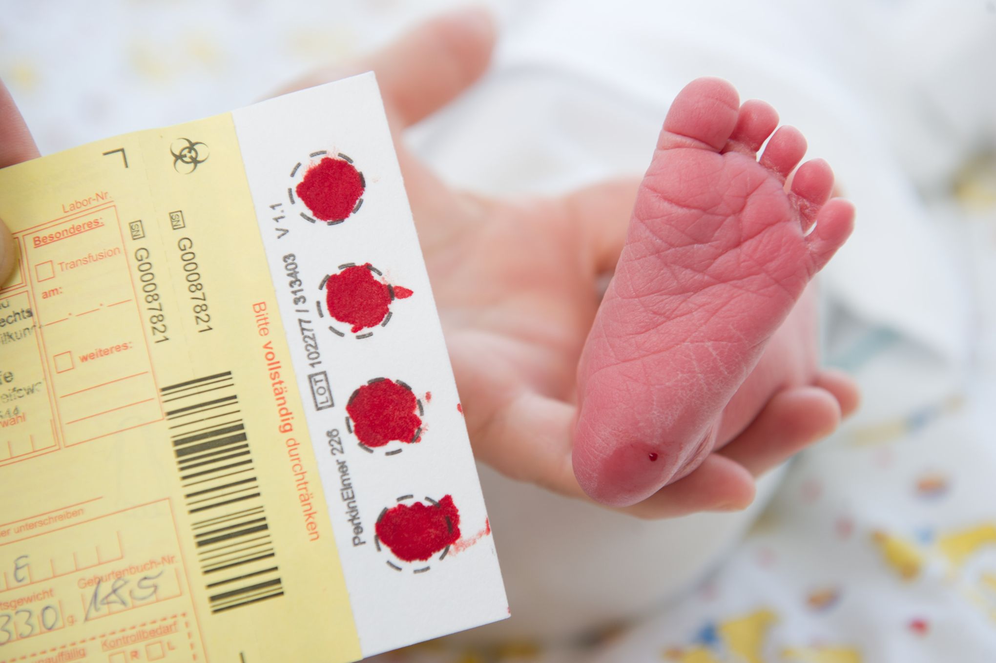 Nouveau-nés : sept nouvelles maladies seront dépistées dès janvier, soit 13  au total - Le Parisien