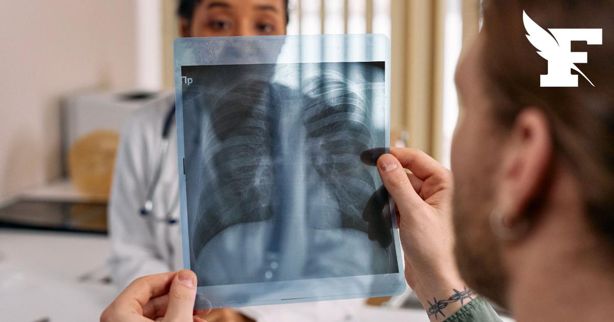 Santé : un cas de tuberculose signalé à Ivry-sur-Seine annonce la mairie
