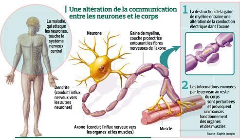 Pistes multiples contre la sclrose en plaques