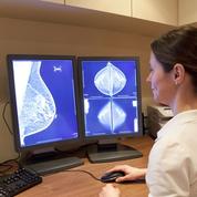 Cancer du sein : «Il était temps de revoir le dépistage»