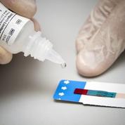 Dépistage du sida : mieux cibler et banaliser
