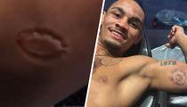 MMA : mordu par son adversaire, il remporte le combat et se fait tatouer les marques de dents sur son corps