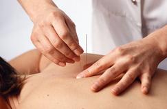 L'acupuncture efficace contre la bronchite chronique 