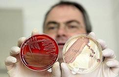 Identifiée, la bactérie tueuse résiste aux scientifiques 
