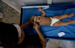 Zika: première naissance d'un bébé microcéphale en Europe