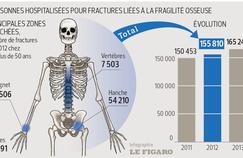 Ostéoporose: 165.000 hospitalisations par an