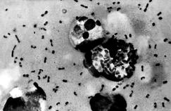 Épidémie de peste noire à Madagascar