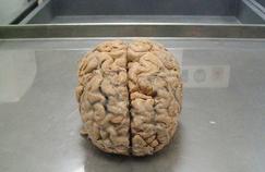 La Belgique reçoit une collection rarissime de cerveaux