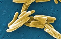 Un nouvel antibiotique contre la tuberculose