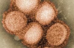 Un virus H1N1 mutant détecté chez le porc 