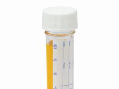 Examen cyto bactériologique urinaire