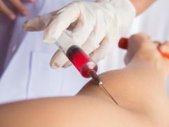 Gros plan sur le bras d'une donneuse pendant un prélèvement de sang