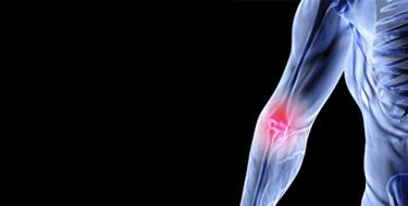 Spondylarthrite maladie auto immune