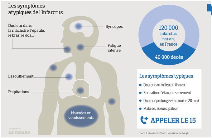 Infarctus Du Myocarde Quelle Douleur Fiches Santé Et Conseils Médicaux