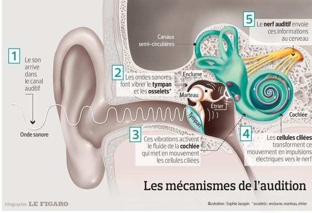 maladie de meniere qu est ce que c est fiches sante et conseils medicaux