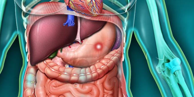 Cancer De L'estomac Stade 4 Symptomes Cancer de l'estomac - Quels signes et symptômes ? - Fiches santé et