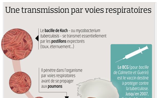 Tuberculose Quest Ce Que Cest Fiches Santé Et Conseils Médicaux