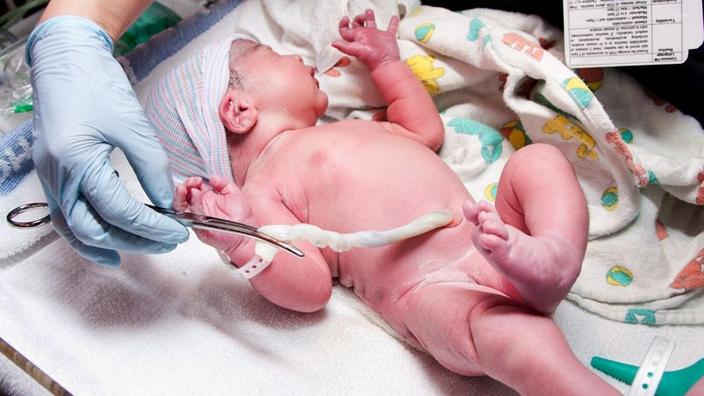 Gli autori dello studio hanno osservato che i bambini i cui cordoni sono stati serrati più di tre minuti dopo la nascita avevano una capacità motoria fine più sviluppata degli altri all'età di quattro anni.'étude ont observé que les enfants dont les cordons ont été clampés plus de trois minutes après la naissance présentent, à l'âge de quatre ans, des capacités motrices fines plus développées que les autres.