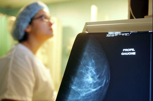 Une Etude Favorable A La Mammographie Avant 50 Ans