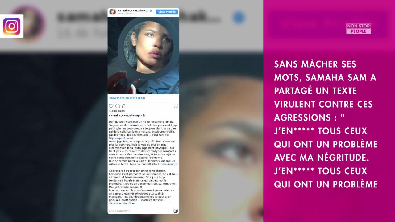 Non Stop People - Samaha Sam de Shaka Ponk : sa réaction virulente après  son agression raciste