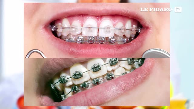 Orthodontie chez les enfants informations et actualit s