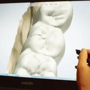 Lyra propose aux dentistes un outil numérique pour fabriquer eux-mêmes les prothèses