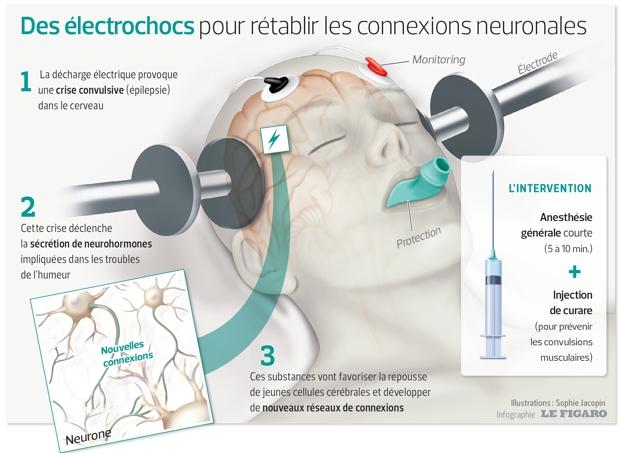 Electrochoc électrochocs : Minutes オリジナル盤 パンク天国 des la