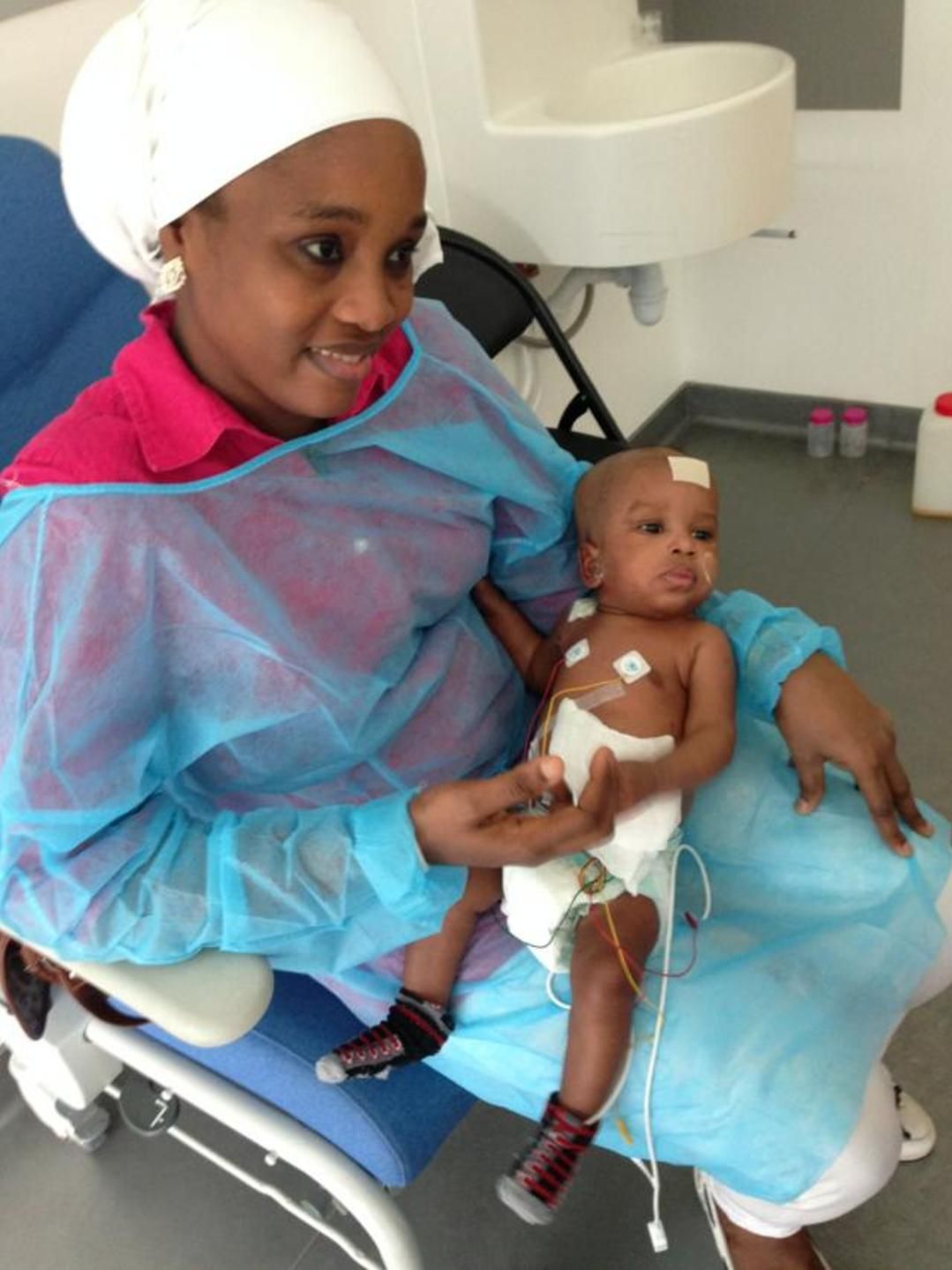 Exploit Chirurgical A Necker Des Bebes Siamois Separes