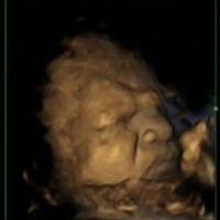 Foetus de 32 semaines qui montre une expression de douleur . Crédit photo: Durham University