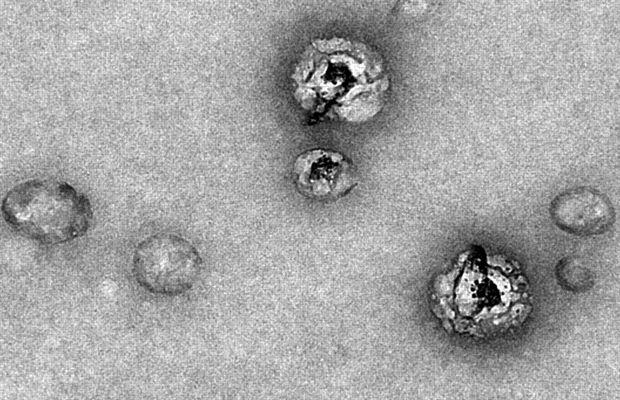 Sur ce cliché, la structure des particules du virus HCV de l'hépatite C (les trois avec un noyau sombre) se distingue des simples lipoprotéines (les deux les plus à gauche et à droite) - Crédit: Copyright Meunier Piver/Inserm