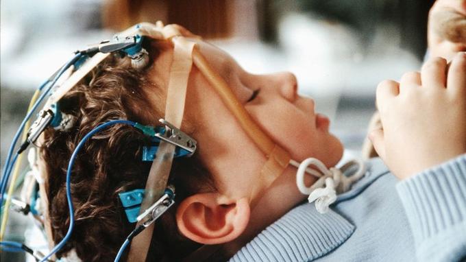 Enfant épileptique passant un électroencéphalogramme.