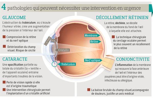 colgante lucha auge Urgences ophtalmologiques : les signes à connaître