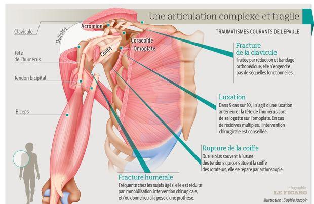 La France En Pointe Pour Soigner Les Traumatismes De L Epaule
