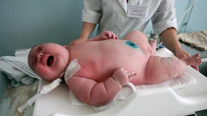 Un Bebe De 7 75 Kg Nait En Russie
