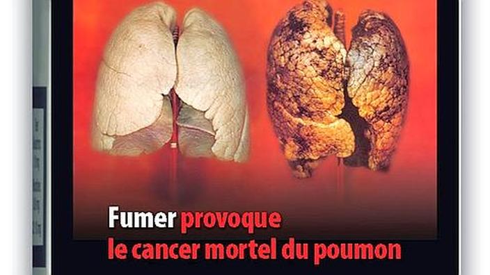 elfbar nachfüll pod läuft aus Impact de la dernière cigarette sur vos poumons main image 1