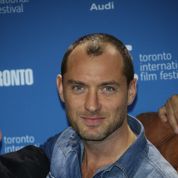 calvitie cheveux long