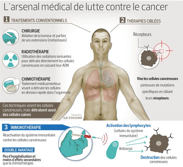 Cancer Poumon Combien De Temps A Vivre AUTOMASITES