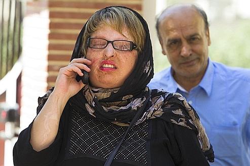 Ameneh Bahrami a été défigurée et rendue aveugle par l'acide en 2004.