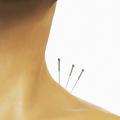 Acupuncture : piqûres de rappel