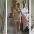Une ado australienne raconte son combat contre l'anorexie