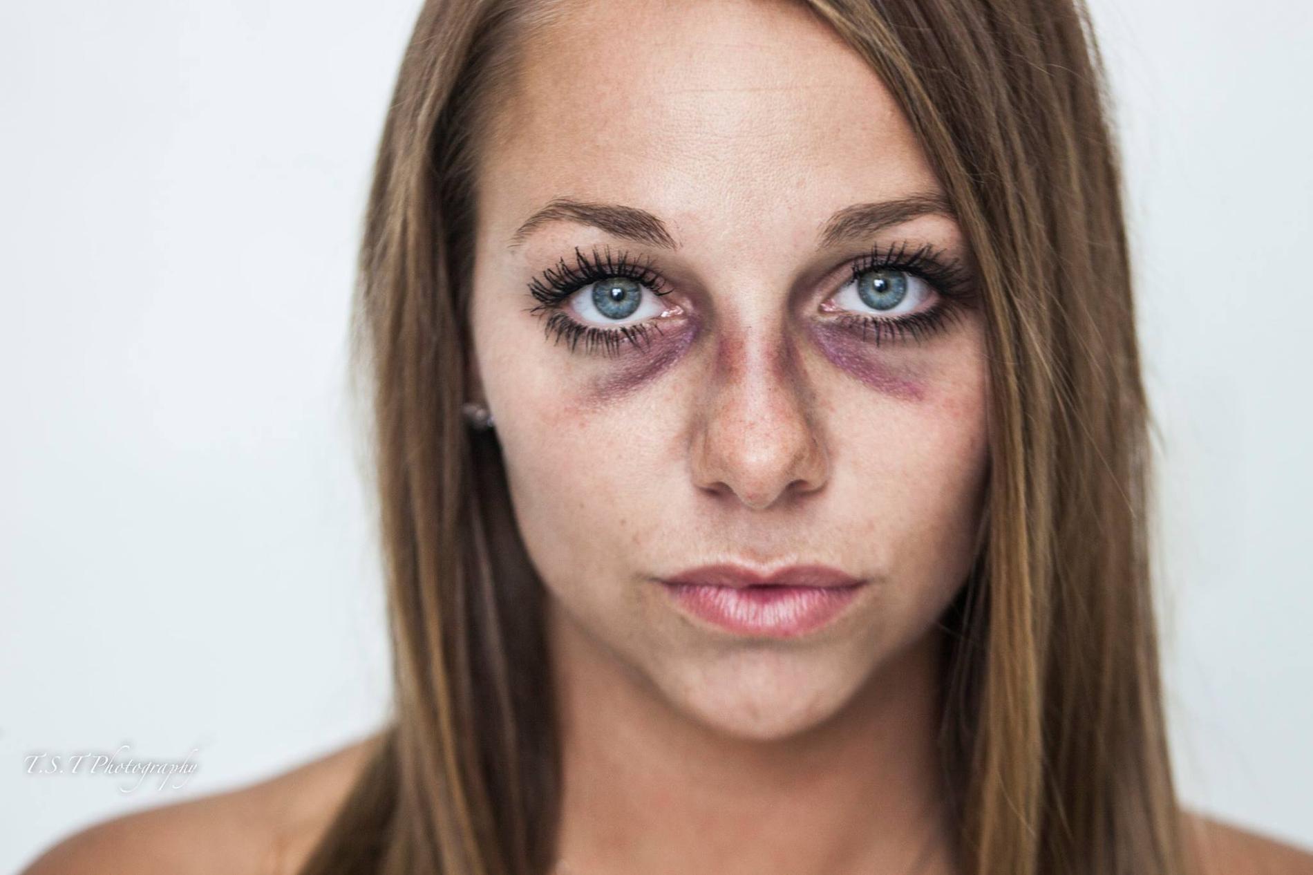 Résultat de recherche d'images pour "photos de femmes battues"