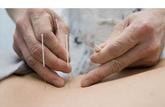 Homéopathie et acupuncture: des médecines encore alternatives?