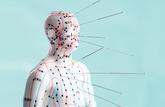 L’acupuncture un appoint aux médicaments